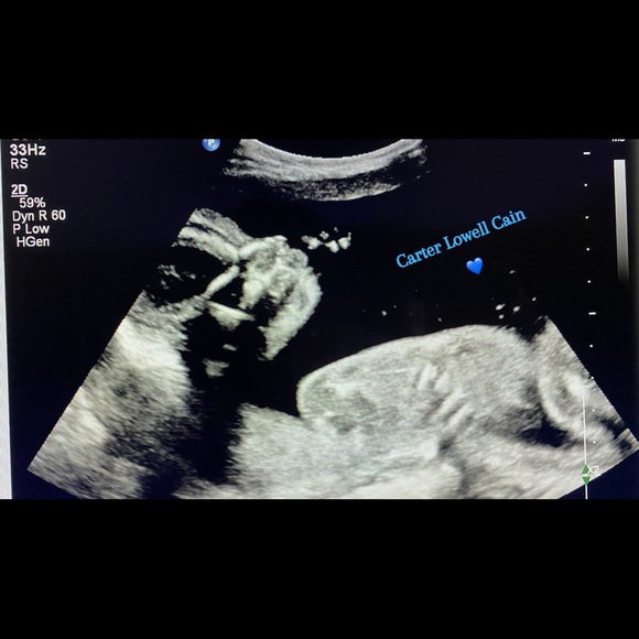 👑 - Picture 3 of 16